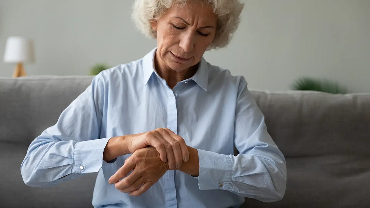 ¿Existe una relación entre el Herpes Zóster y la Artritis Reumatoide?